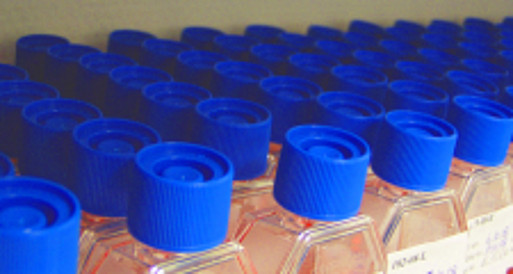 culture flask